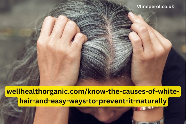 wellhealthorganic.comknow-the-causes-of-white-hair-and-easy-ways-to-prevent-it-naturally
